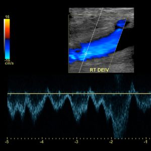 Oakstone A Comprehensive Review of Vascular Ultrasound Interpretation & Registry Preparation 2020