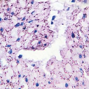 Oakstone Gastropathology 2021