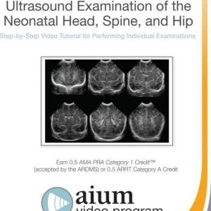 American Institute of Ultrasound in Medicine Practice Parameter for Ultrasound Examination of the Neonatal Head, Spine, and Hip 2017