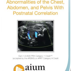 American Institute of Ultrasound in Medicine Prenatal Ultrasound Abnormalities of the Chest, Abdomen, and Pelvis With Postnatal Correlation 2018