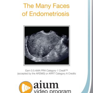 American Institute of Ultrasound in Medicine The Many Faces of Endometriosis 2015