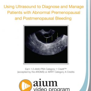 American Institute of Ultrasound in Medicine Ultrasound to Diagnose and Manage Patients with Abnormal Premenopausal and Postmenopausal Bleeding 2015