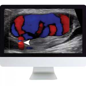 American Roentgen Ray Society Clinical Ultrasound Review 2017