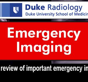 Meetings By Mail Duke Radiology - Emergency Imaging 2017