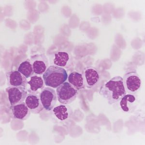 Oakstone Hematopathology 2021