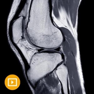 Oakstone UCSF Neuro and Musculoskeletal Imaging 2022