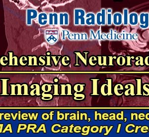 Meetings By Mail Penn Radiology Comprehensive Neuroradiology Imaging Ideals 2022