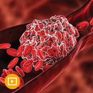 Oakstone Thrombosis & Thromboembolism 2022