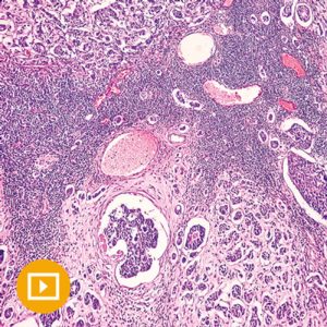 Oakstone Breast Pathology 2023
