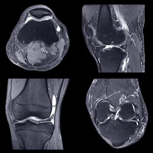 Oakstone NYU Langone Advanced Imaging of the Musculoskeletal System Up Your Game 2023