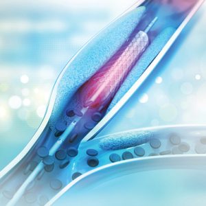 Oakstone Comprehensive Review and Update of What’s New in Vascular and Endovascular Surgery 2023