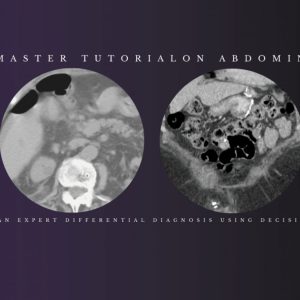CME Science Federle’s Master Tutorial on Abdominal Imaging How to Develop an Expert Differential Diagnosis using Decision-Support Tools Dec 2021