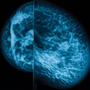 Oakstone UCSF Breast Imaging 2024