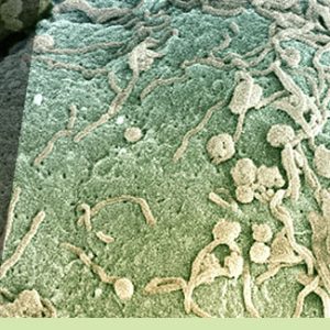 Memorial Sloan Kettering Cancer Center 5th Annual MSK Symposium on Lymphoma 2021