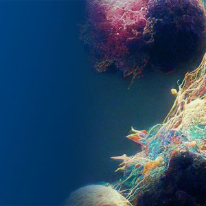 Memorial Sloan Kettering Cancer Center 7th Annual MSK Symposium on Lymphoma 2023