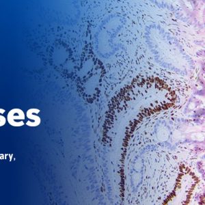 Memorial Sloan Kettering Cancer Center The Pathology of Neoplastic Diseases 2024