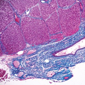 Oakstone Current Topics in Gastrointestinal and Liver Pathology 2023