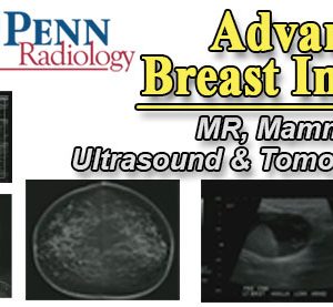 Meetings By Mail Penn Radiology Advanced Breast Imaging 2014
