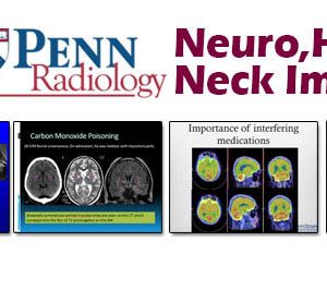 Meetings By Mail Penn Radiology Neuro, Head & Neck Imaging 2013