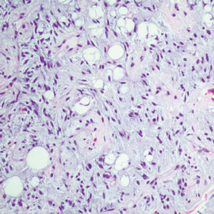 Oakstone Cleveland Clinic Comprehensive and Immersive Soft Tissue Pathology 2025