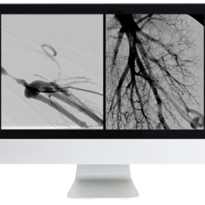 American Roentgen Ray Society Case Review of Vascular and Interventional Radiology 2023