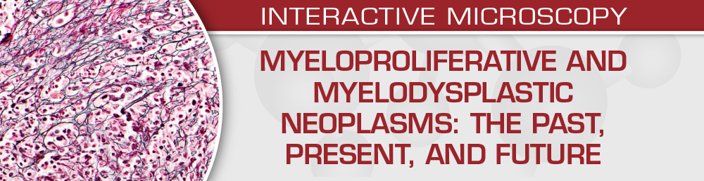 USCAP Myeloproliferative and Myelodysplastic Neoplasms The Past, Present, and Future 2024