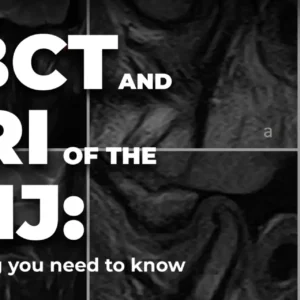 OHI-S CBCT and MRI of the TMJ everything you need to know