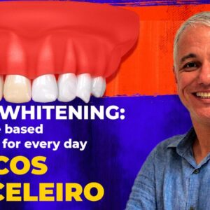 OHI-S Dental bleaching the science based techniques for every day