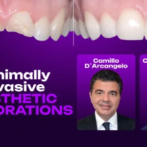 OHI-S Minimally Invasive Aesthetic Restorations Additive, Digital, and Fully Functional Rehabilitation