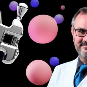 OHI-S Orthodontics in growing patients