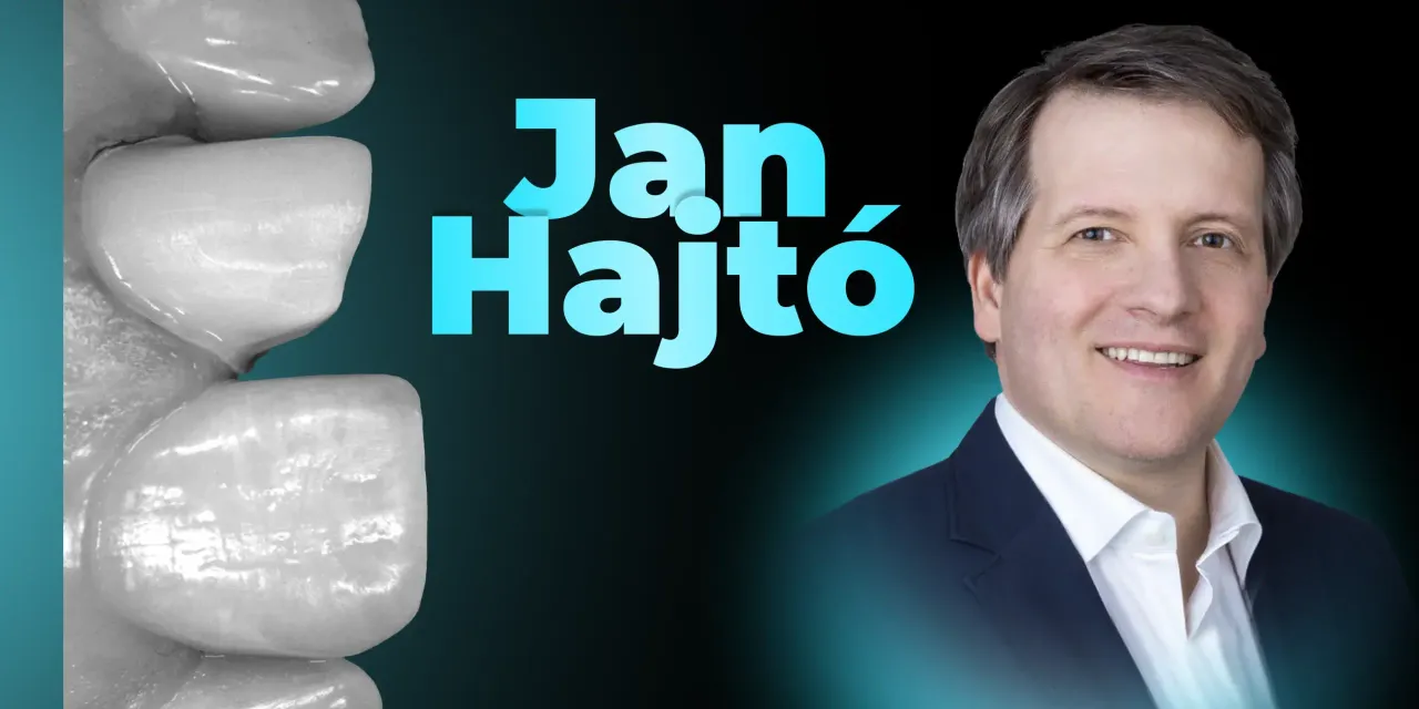 OHI-S Precision in Laminate Ceramic Veneers Tooth Preparation and Adhesive Cementation Techniques