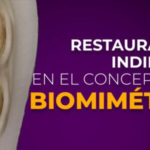 OHI-S Restauración indirecta en el concepto de biomimética Spanish