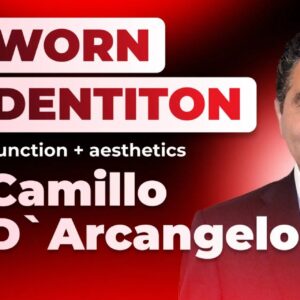 OHI-S Treatment of pathological tooth wear. Additive prosthodontics. The concept Aesthetics-Function-Posture 10 lession 19h36m
