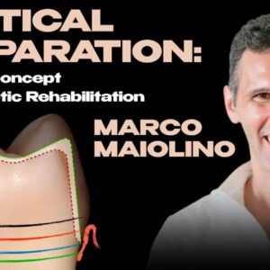 OHI-S Vertical Preparation Updated Concept for Aesthetic Rehabilitation 17 lessons 8h 44m