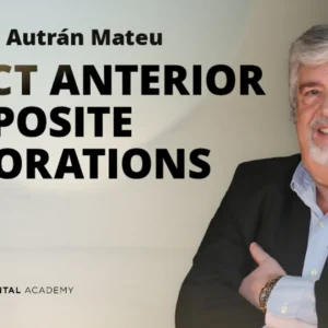 Osteocom Direct Anterior Composite Restorations