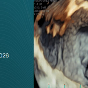 Harvard Boston 3D Echo Workshop 2026
