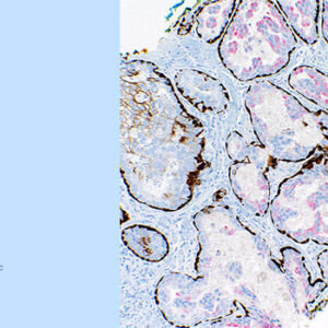 Memorial Sloan Kettering Cancer Center The Pathology of Neoplastic Diseases 2026