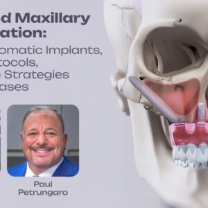 OHI-S Advanced Maxillary Rehabilitation Guided Zygomatic Implants, All-on-X Protocols, and Rescue Strategies for Failed Cases 3 lessons 3h 21min