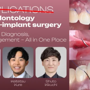 OHI-S Complications in Periodontology and Peri-implant Surgery Prevention, Diagnosis, and Management - All in One Place 5 lessons 4h 33min