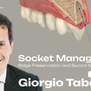 OHI-S Socket Management Ridge Preservation and Buccal Shield Techniques 3 lessons 57min