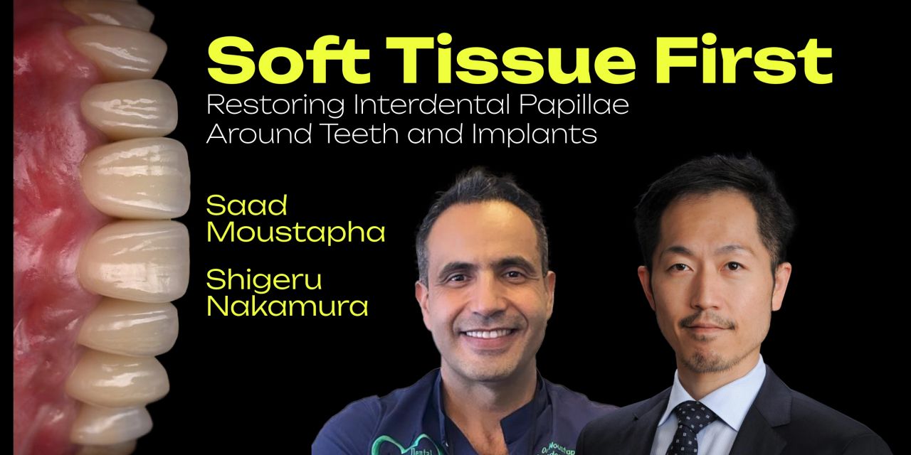 OHI-S Soft Tissue First. Restoring Interdental Papillae Around Teeth and Implants 4 lessons 2h 11min