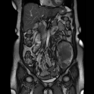 Oakstone NYU Langones Clinical Updates in Body, Chest, and Oncologic Imaging 2026